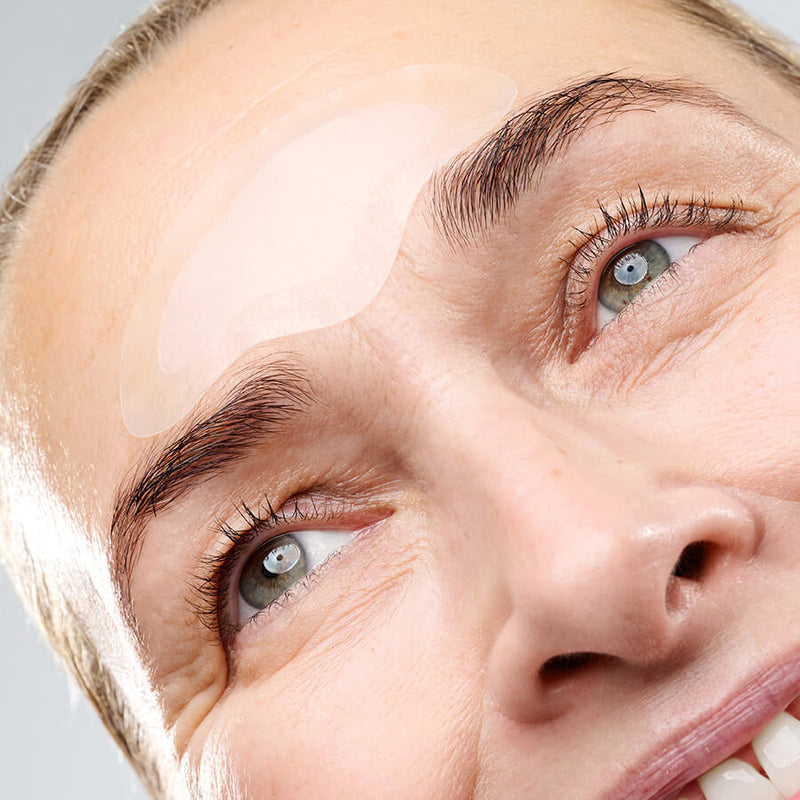 Forehead Microneedling Patch